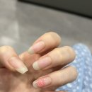 하나로의료재단 건강검진 후기 (위내시경 / 수면내시경 젤 네일)