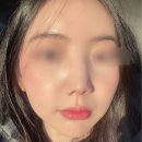 손한의원 | 리쥬란 대신 선택한 미주란 힐러｜수원 인계동 한의원 솔직 후기