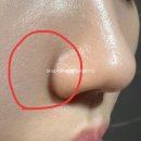 라곰(LAGOM) | 올리브영 클렌징오일 추천 / 코옆피지 모공클렌징 라곰클렌징오일 사용후기