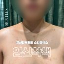 (주)우성제약 | 일산 산전관리 및 잡티제거 스킨플렉스 관리 후기