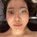 끌리메 대전 관저점 | 대전 에스테틱 골드페이스라인 후기