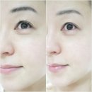 예스압구정 이미지