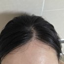 [내돈내산] 루솔브 비오티아S 스칼포필 탈모완화 샴푸 후기 막힌 모공부터 모근 영양까지 한 번에 케어