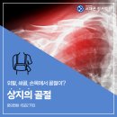 송파관절병원에서 알려드리는 여름철 주의 골절질환, 상지의골절은? 이미지