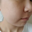 재생에 좋은 EGF 앰플 비피에스 파지산세럼 사용후기
