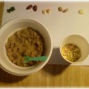 이안덴탈 이미지