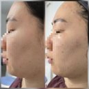 엄궁파출소 | [부산/사상구] '이곳피부샵' 피부 트러블, 피지관리 후기