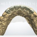월드치과기공소 이미지