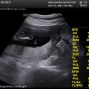 주차16 | [임신16주차] 성별공개!!/ 2차기형아검사 및 결과/ 16 주차 증상 및 후기