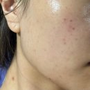 최주현피부과의원 이미지