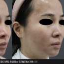 아루다의원 | 엑소좀 후기에 따른 효과에 대한 견해