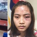 [사건사고] 한국의 공장에서 중국인 관리자에게 성추행과 구타를 당한 캄보디아 여성 이미지