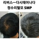 탈모응급실 리버스-다시태어나다 이미지