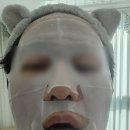 (주)휴셀 | 피부면역충전소 휴셀 : nk세포 수분마스크팩 직접한후기