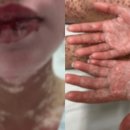 나겸피부관리