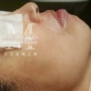 미케어셀 이미지