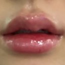 닥터에버스의원 미사점 | [입술필러] 만족스러운 입술필러 리터치 후기(미사 닥터에버스의원)