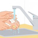 가벼운 화상 입었을 때 응급처치: 물집 관리 이미지