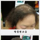 에이모가발 이미지
