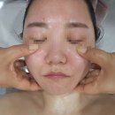 4679 | 낙성대에스테틱 유채경피부관리 윤곽관리 받고 온 후기