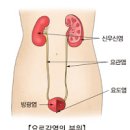 소변 색깔 갈색 피 혈뇨 원인 이미지