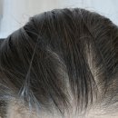 하수구 닥터(Dr) | 닥터토비아 모낭활성제 카페인 헤어인핸싱폼, 요즘 두피보호제 추천 1순위 인정