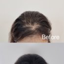 새로이숲부평 이미지