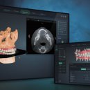 라온 소프트 이미지