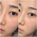 건조한 피부 속 채워주는 인셀덤 ICD 오일 미스트 사용 후기