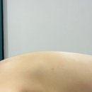 홍스킨 - 용인시 기흥구 | 홍스킨
