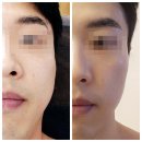코사마트울산점달동 | 울산 달동 윤곽관리 스킨포유 남구 피부관리 잘하는 곳 추천