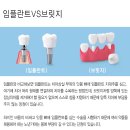바른이플란트치과의원 이미지