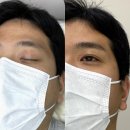 준디자인 - 광양시 | 동두천 포천남자눈썹문신 요청사항 제대로 반영한 디자인 설계해준 리메이드 양주옥정점 후기