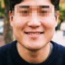통영장치과의원 | 남자 턱 보톡스, 피부과 vs 치과 후기