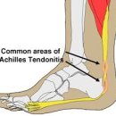 내곡동301 이미지