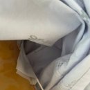 [신장 치료 일기] 20cm 콩팥물혹 판정? 수신증 증상과 감압술 후기 (+신배게실)