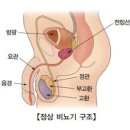 전립선 암의 정확한 원인은? 이미지