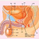 전립선비대증 육미지황탕 효과 이미지