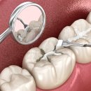 내원백운 이미지