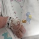 세븐일레븐 정읍건강공단점 | 아주대 만삭아 니큐 입원기록｜신생아호흡곤란, 폐표면활성제, 병원비