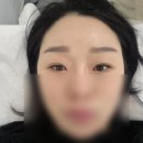 구로 속눈썹 연장 잘하는 곳, 더예쁜속눈썹 솔직 후기