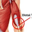 디클리셰 이미지