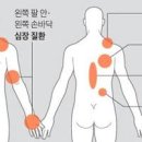 오른쪽 왼쪽 가운데 등 통증 원인 이미지