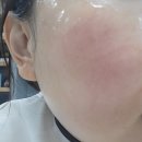 퀸즈인셀덤 | 옥길동피부관리/ 인셀덤 전 제품 체험해봄!