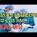 맹장(충수)를 제거하면 면역이 약해진다고? 맹장염(충수염)을 관리해야하는 핵심 이유! 이미지