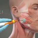 도도성형외과 - 동대문구 천호대로 425 | 수원 동안성형 이마거상재수술 후기 가능한 범위부터 봤어요