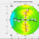 눈사람안과의원 이미지