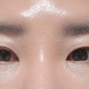 온오프피부과의원 네이버블로그