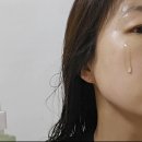 포레세