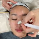 119 | 부산 서면 모공관리 뷰티119의 트라이엄 후기